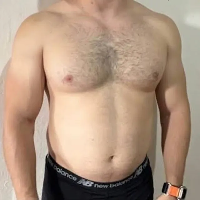 Antes: tronco de paciente masculino, de frente